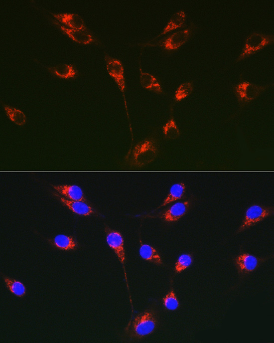 Tenascin C Rabbit polyclonal antibody