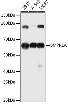 BMPR1A Rabbit polyclonal antibody