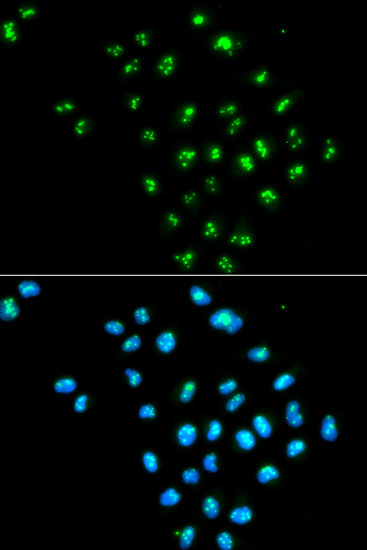 EIF6 Rabbit polyclonal antibody