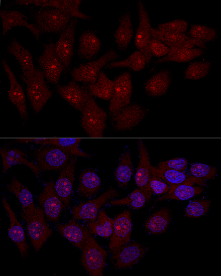 EIF6 Rabbit polyclonal antibody