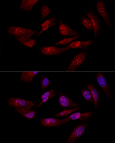EIF6 Rabbit polyclonal antibody