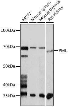 PML Rabbit polyclonal antibody