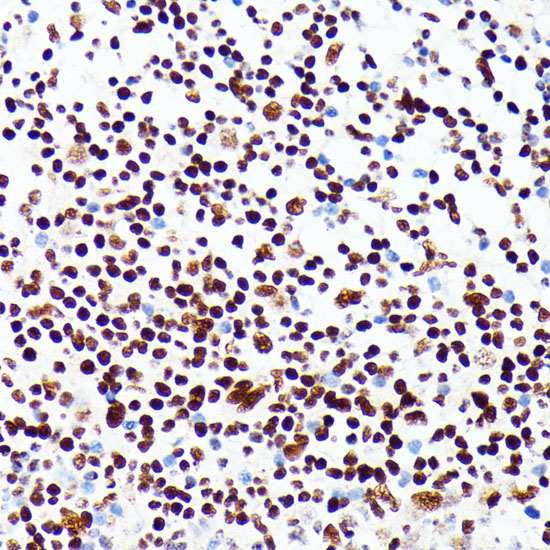 PML Rabbit polyclonal antibody