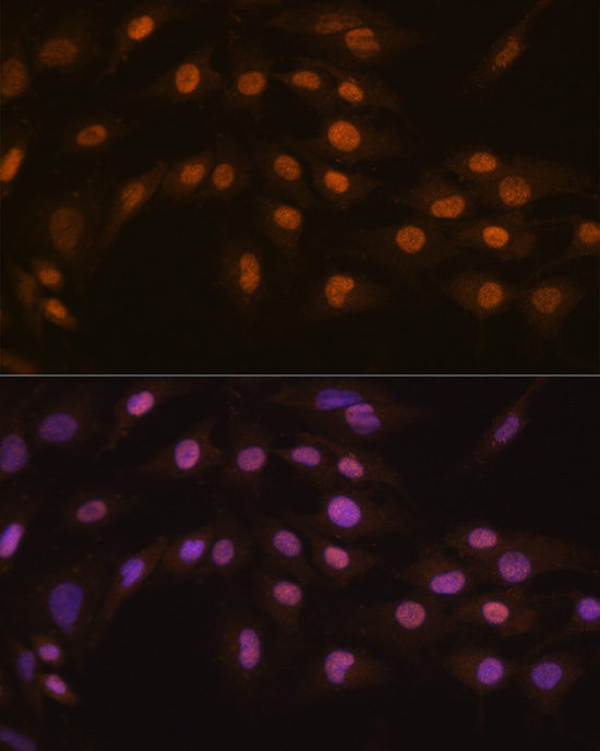 ZFPM1 Rabbit polyclonal antibody
