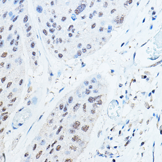 Ubiquitin Rabbit polyclonal antibody