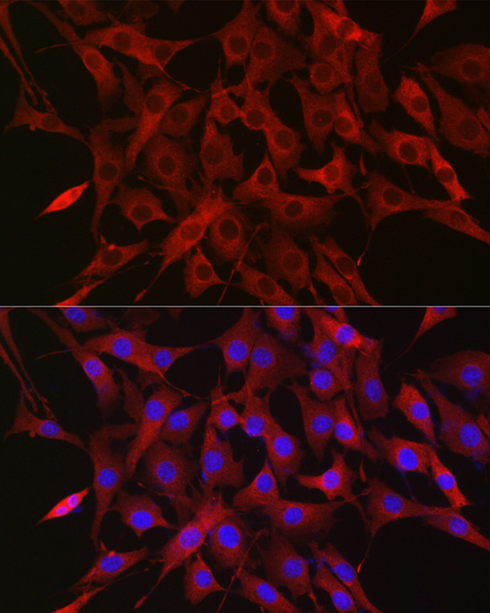 Ubiquitin Rabbit polyclonal antibody