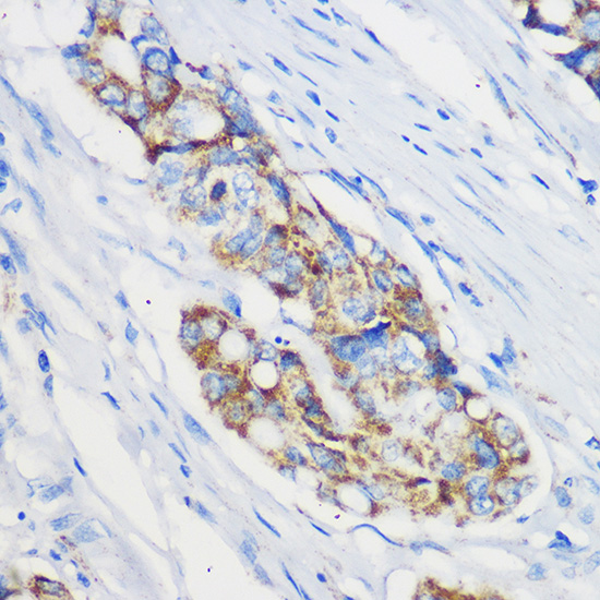 Mrpl46 Rabbit polyclonal antibody