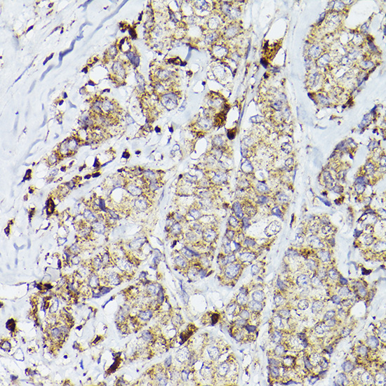 PSAP Rabbit polyclonal antibody