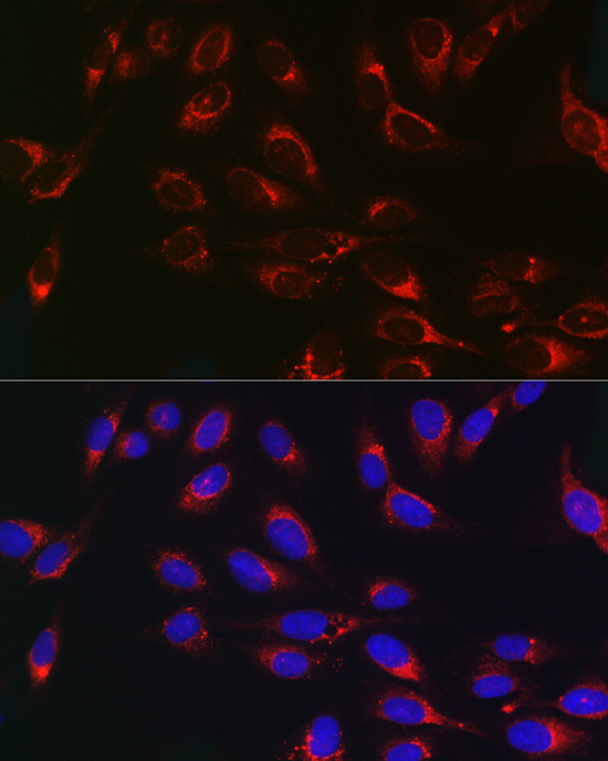 PSAP Rabbit polyclonal antibody