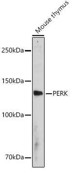 PERK Rabbit polyclonal antibody