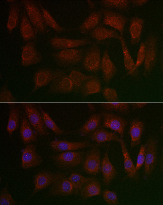 PERK Rabbit polyclonal antibody