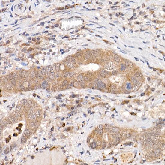 KEAP1 Rabbit polyclonal antibody