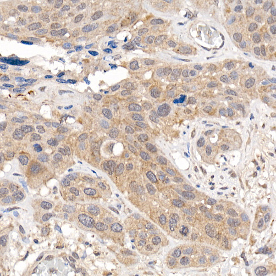 KEAP1 Rabbit polyclonal antibody