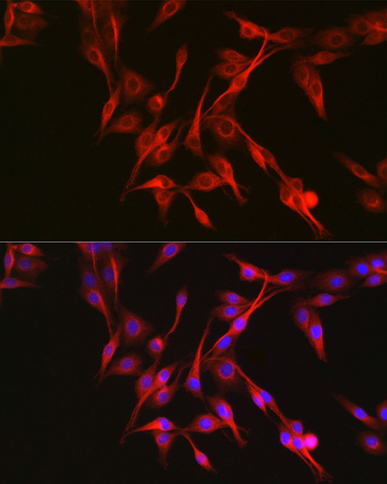 KEAP1 Rabbit polyclonal antibody