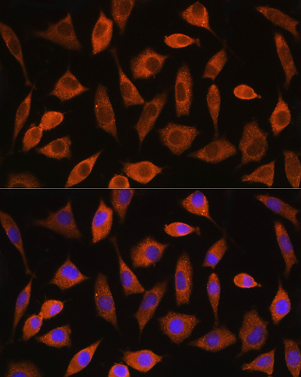 EIF2B4 Rabbit polyclonal antibody