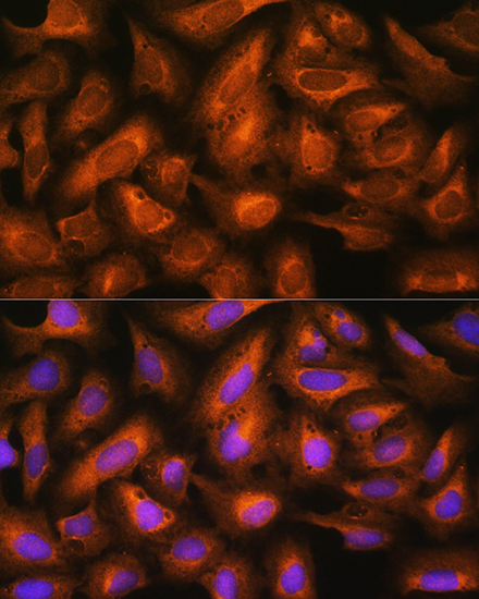 EIF2B4 Rabbit polyclonal antibody