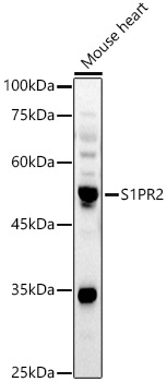S1PR2 Rabbit polyclonal antibody