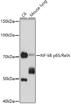 NF-kB p65/RelA Mouse mAb