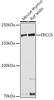 ERCC6 Rabbit polyclonal antibody