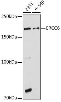 ERCC6 Rabbit polyclonal antibody
