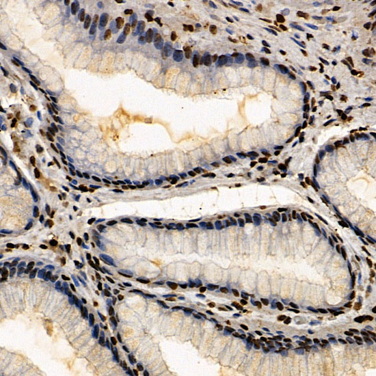 ERCC6 Rabbit polyclonal antibody