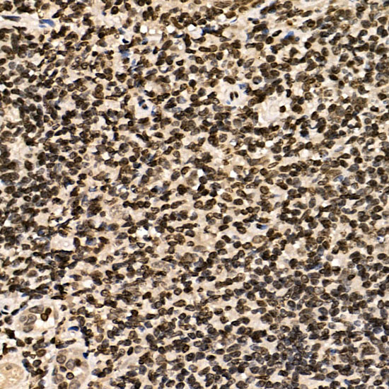 ERCC6 Rabbit polyclonal antibody