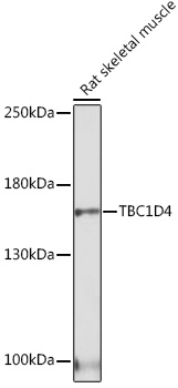 TBC1D4 Rabbit polyclonal antibody
