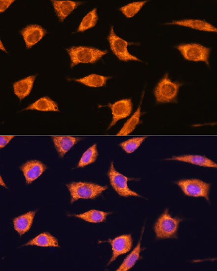 TBC1D4 Rabbit polyclonal antibody