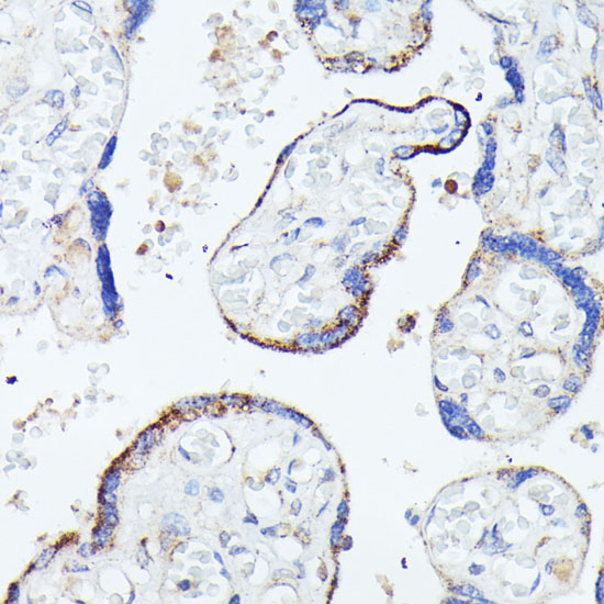 HSPB11 Rabbit polyclonal antibody