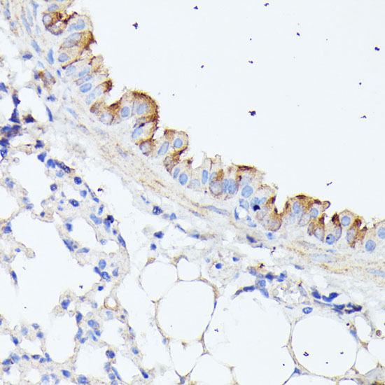 HSPB11 Rabbit polyclonal antibody