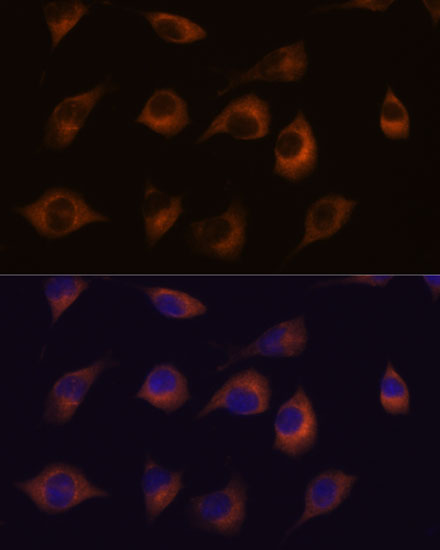 HSPB11 Rabbit polyclonal antibody