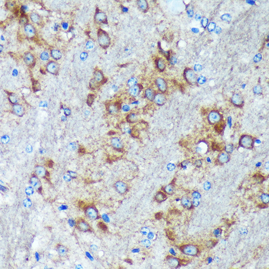 GRSF1 Rabbit polyclonal antibody