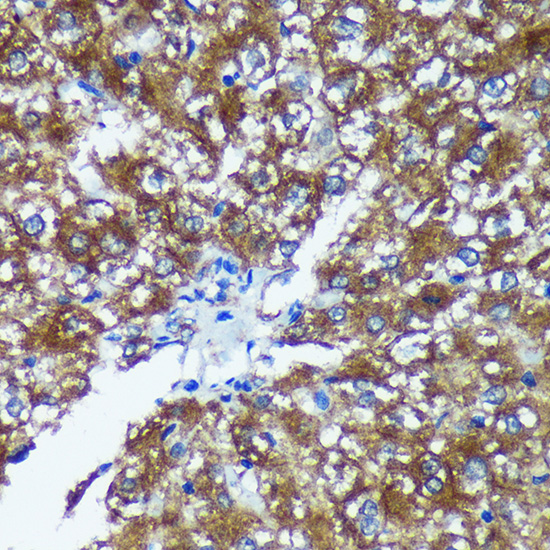 GRSF1 Rabbit polyclonal antibody