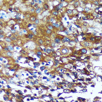 GRSF1 Rabbit polyclonal antibody