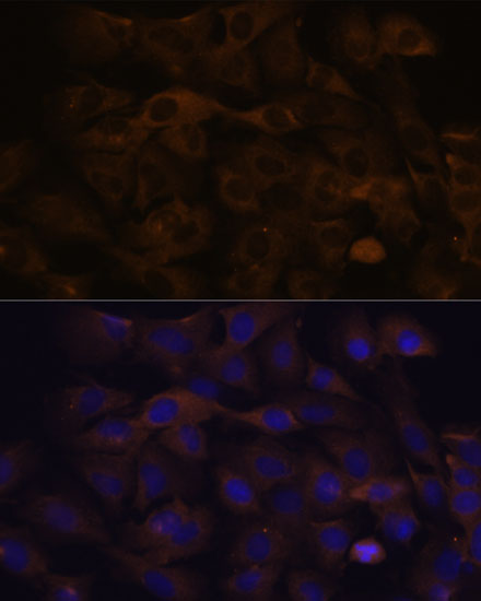 GRSF1 Rabbit polyclonal antibody