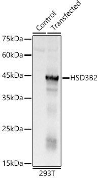 HSD3B2 Rabbit polyclonal antibody
