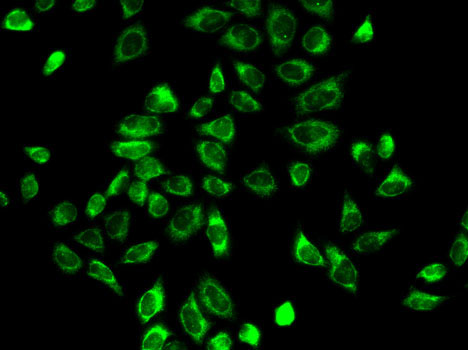 HSD3B2 Rabbit polyclonal antibody