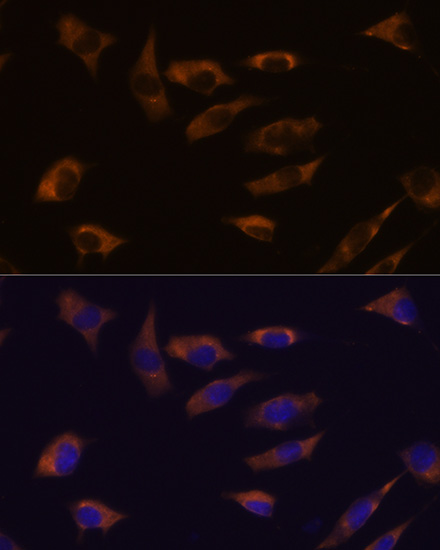 FSTL4 Rabbit polyclonal antibody