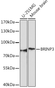 BRINP3 Rabbit polyclonal antibody
