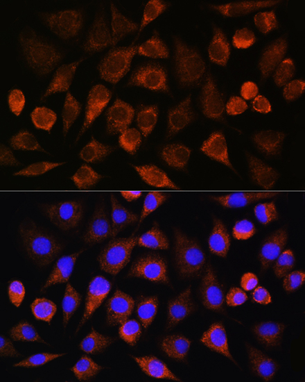 BRINP3 Rabbit polyclonal antibody