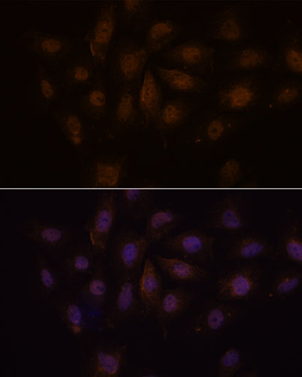 MED15 Rabbit polyclonal antibody