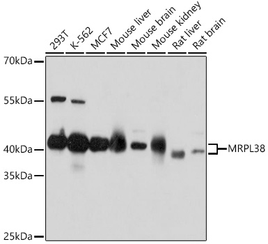 MRPL38 Rabbit polyclonal antibody