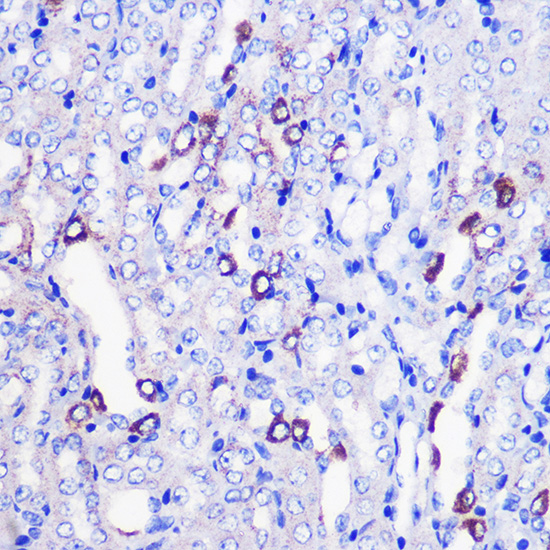 MRPL38 Rabbit polyclonal antibody