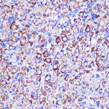 MRPL38 Rabbit polyclonal antibody