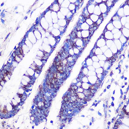 MRPL38 Rabbit polyclonal antibody