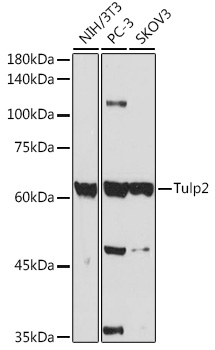 Tulp2 Rabbit polyclonal antibody