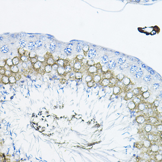 Tulp2 Rabbit polyclonal antibody