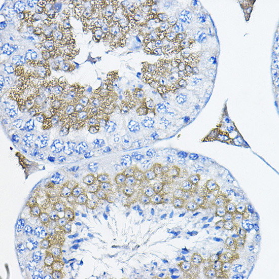 Tulp2 Rabbit polyclonal antibody