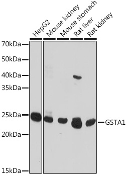 GSTA1 Rabbit polyclonal antibody