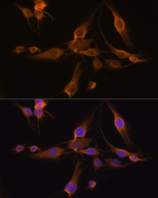 GSTA1 Rabbit polyclonal antibody
